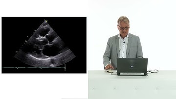 What patterns are there in the bullseye display?