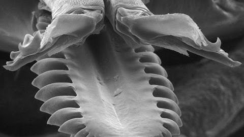 Gross! Watch a Tick Bite in Action Video - LiveScience 29-10-2013