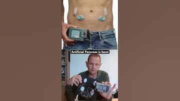 This Artificial Pancreas automates EVERYTHING using insulin and glucagon #t1d #diabetes