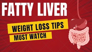 FATTY LIVER TREATMENT | Fatty Liver Weight loss tips | Liver detox