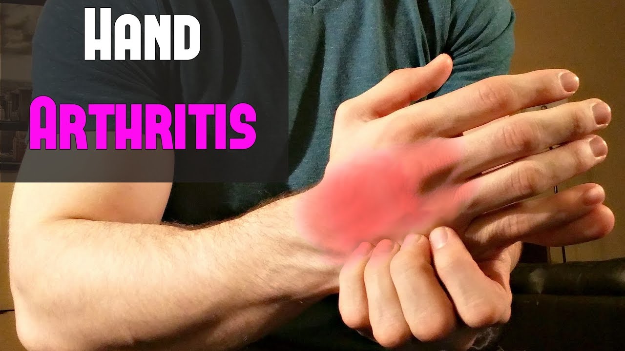 Top 10 Best Gadgets & Products for Arthritis in Hands