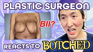 Plastic Surgeon Reacts to BOTCHED: Breast Implant Illness (BII) in a Celebrity!