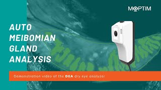 Automatic Meibomian Glands Analysis With Dea Dry Eye Analyzer By Moptim
