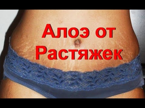 Как убрать растяжки на животе