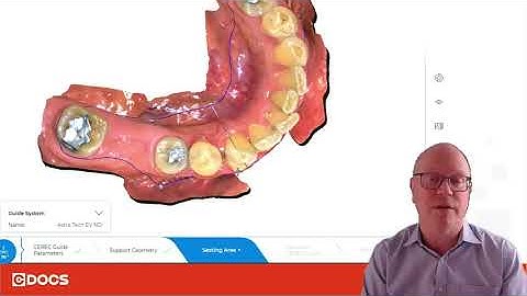 Tip of the Day: Trimming the Guide