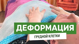 Деформация грудной клетки - последствия посещения стоматолога.