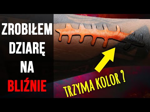 BLIZNA I TATUAŻ: czy można tatuować blizny? | Wszystko o tatuażach #20