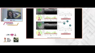 KSOS2024 IC64 T2 Dr Swetha K Role of OCT in detecting glaucoma progression