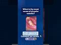 What’s the most common cause of alveolar osteitis ?#dentlecthub #neetmds #oralsurgery #dentalstudent
