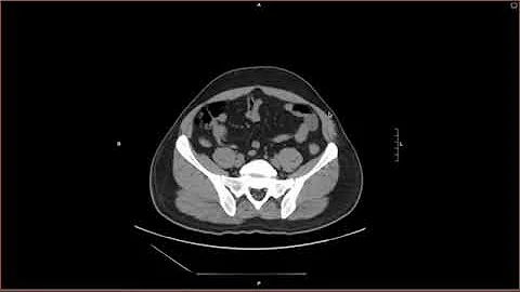 A Practical Introduction to CT -What the Radiologist should know