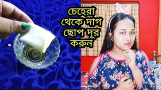 |বাড়িতই ফ্রি তে ফেশিয়ালের মতো দাগমুক্ত চেহারা পাবেন|7 days Challenge Remove Dark Spots/Pigmentation|