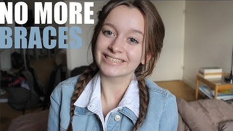 NEW SMILE | Mes bagues & les réponses à vos questions ! ♡
