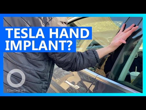 Bro implants Tesla