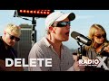 DMA'S - Delete ACOUSTIC | Live From Sydney | Radio X