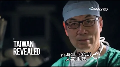 Fu Chan Wei Discovery Documentary - Vascularized Fibula (Jaw Reconstruction) 下颚重建-台湾整形外科权威-魏福全教授 - 天天要闻