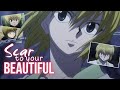 Kurapika amv scars to your beautiful