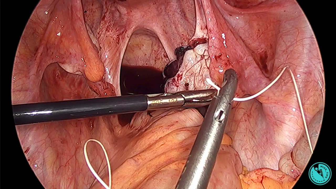 Needle Handling ABCs