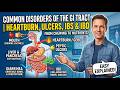 Common Disorders of the GI Tract | Heartburn, Ulcers, IBS & IBD