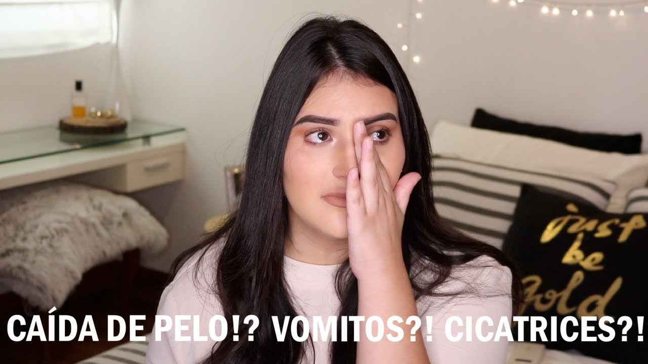 3 MESES DESPUÉS DE MI CIRUGÍA | MI CIRUGÍA DE MANGA GÁSTRICA