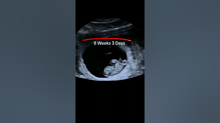 Ultrasound showing 8 weeks 3 days baby #baby #ultrasound #pregnant #shorts