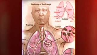 MESOTHELIOMA-LAWYER-DIRECTORY.COM
