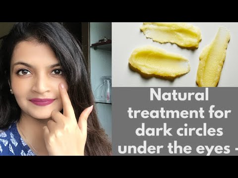 Dark circles are caused by many factors including stress, lack of sleep, nutritional deficiency or just weather changes. i have the simplest home remedy for ...