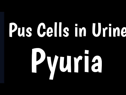 Cellules de pus dans l'urine | Qu'est-ce que le pus et la pyurie | Causes, symptômes, taux normal...