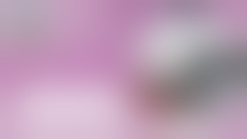 Calcaneal Fractures Prof  Ahmed Kholeif