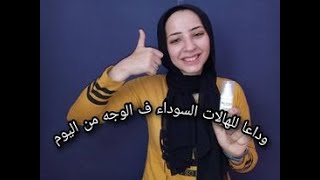 اراهنك انك هتتخلصي من الهالات السوداء خلال 3 ايام بعد الفيديو ده