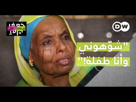 معاناة السودانية عزيزة مع عادة الشلوخ التي تمزق وجه الفتيات