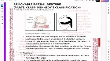 Prosthodontics Made Easy Second Part - RPD, Clasps!