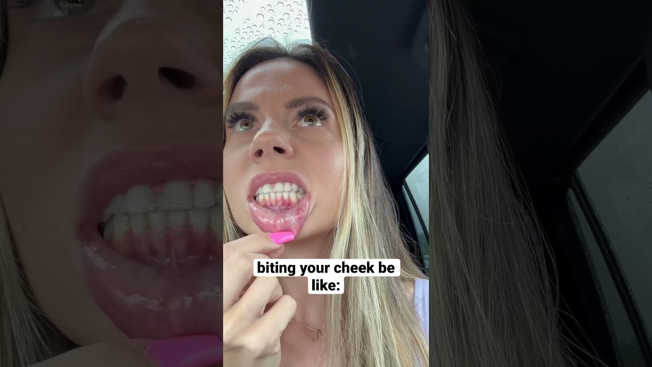 WHEN YOU ACCIDENTALLY BITE YOUR CHEEK