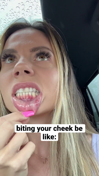 WHEN YOU ACCIDENTALLY BITE YOUR CHEEK