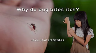 Why do bug bites itch?