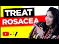 Treat Rosacea Doctors Tips| Asian/ Black Skin |  Rosacea Mistakes | Rosacea Skin Care