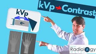 kVp and x-ray Contrast (Guide for Radiologic Technologists) screenshot 5