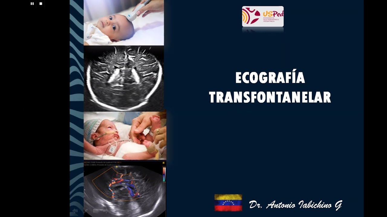 01.2024. Ecografia transfontanelar y POCUS. Dr. Antonio Iabichino 🇻🇪