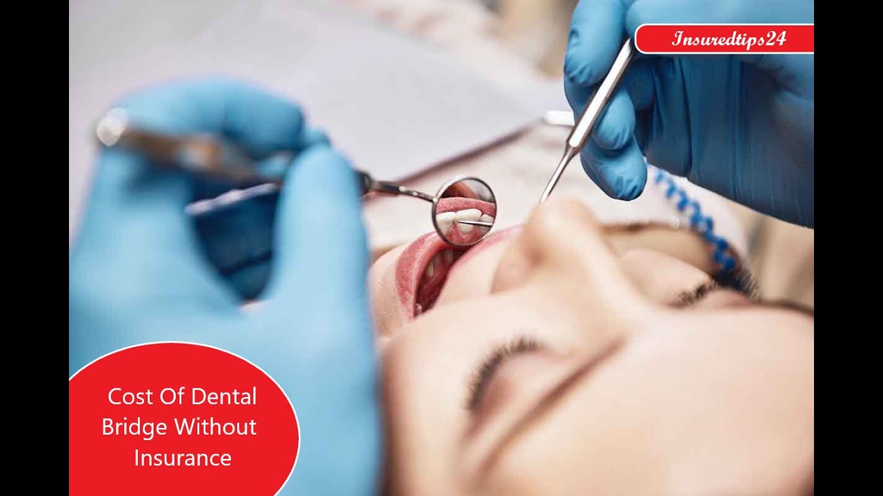 What is the cost of dental bridge without insurance YouTube