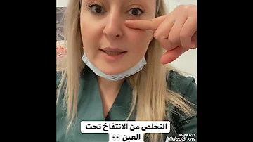 طريقة طبيعية فعاله جدا للتخلص من انتفاخات حول العينين جربوها 