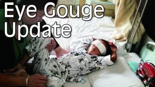Police Identify Assailant That Gouged Boys Eyes Out