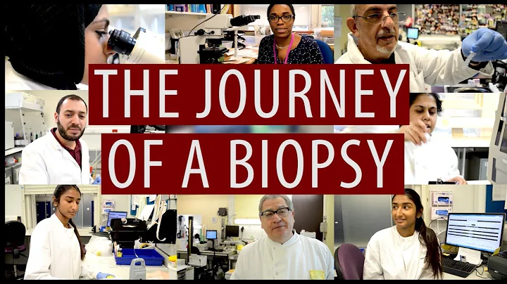 The journey of a biopsy #DiscoverPathology