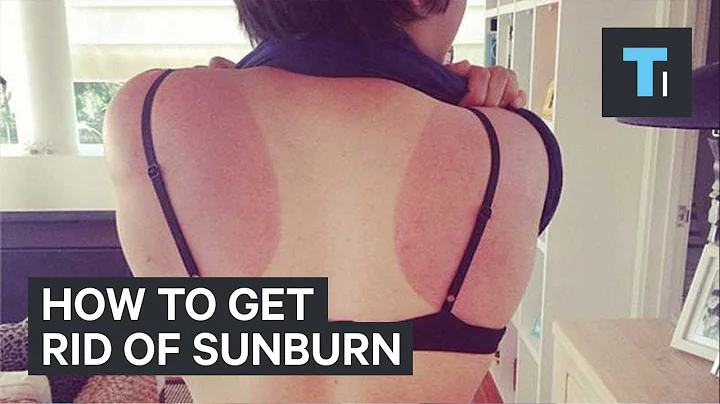 How to get rid of sunburn - DayDayNews