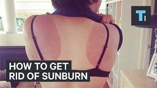 Every year, millions of beach-goers forget to wear sunblock and suffer
the sun's wrath with painful red sunburns. dermatologist dr. erin
gilbert reveals one ...