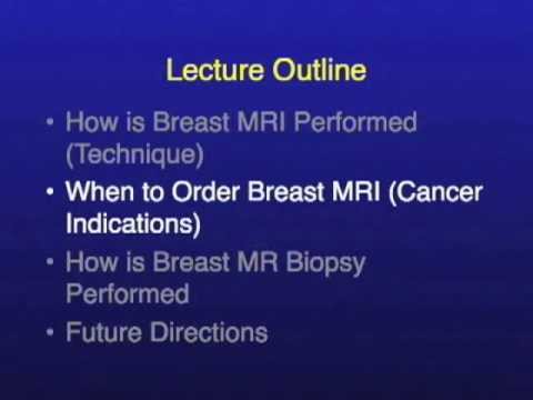 UCSF Radiology: When is a Breast MRI Exam Needed? - YouTube