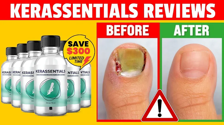 Kerassentials Review 2023 | Dr Kimberly Fungus Tre...
