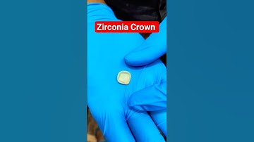 Zirconia Crown #zirconia cap #metal free cap #most esthetic crown