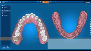 3. Segmentation ( Digital Orthodontic Software, DICAON 4D v1.6.1.0 )