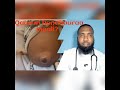 Umbilical Hernia Qaawwa Handhuuraa Maali 