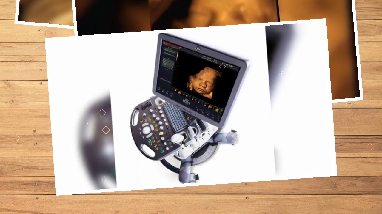 3d/4d sonography. Level 2 sonography. TIFFA scan. Anomalies scan