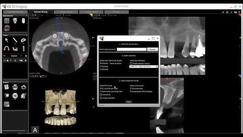 CS 3D Imaging   Exporting Volumes
